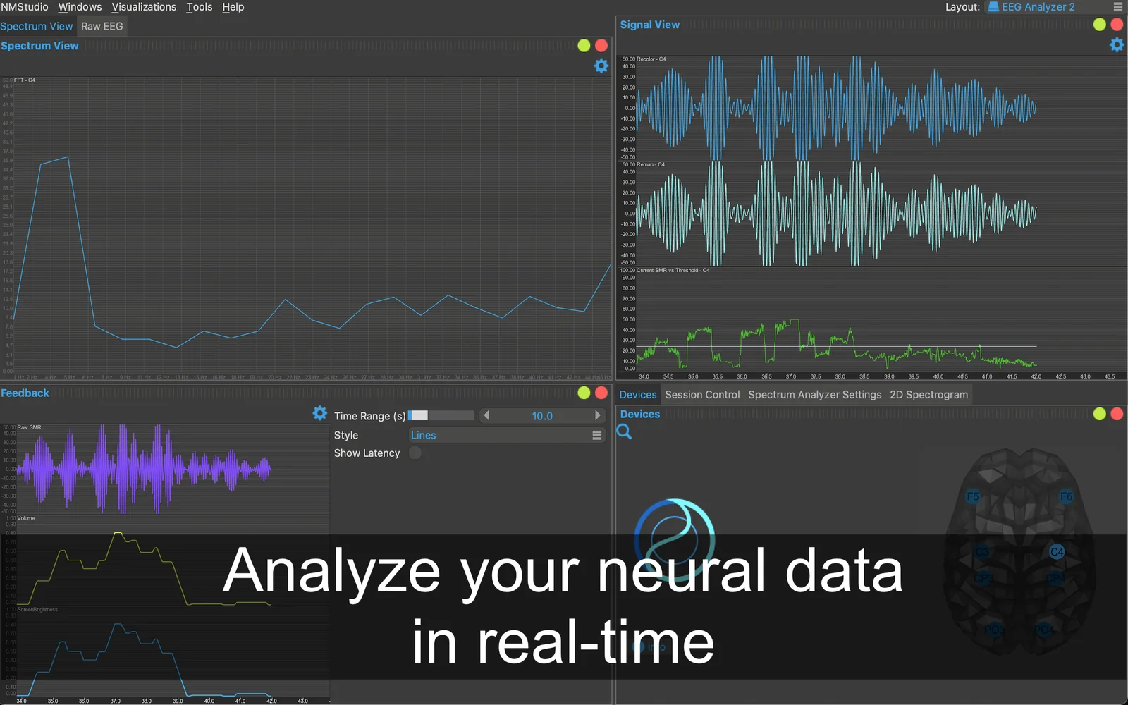 neuromore EEG analyzer