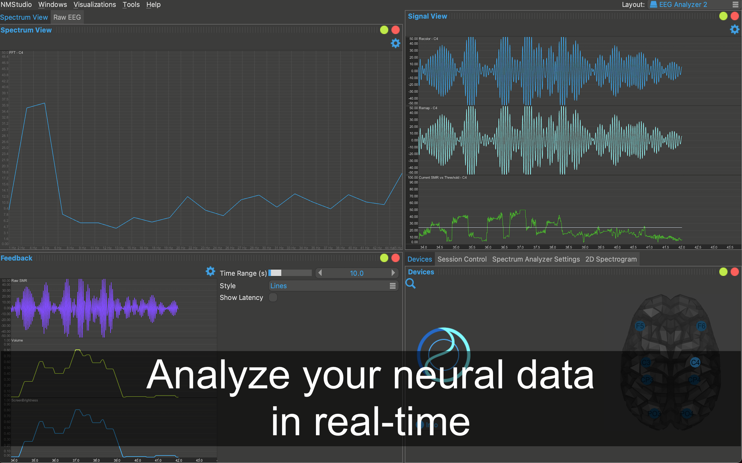 neuromore EEG analyzer